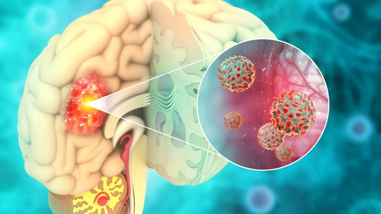 Una nueva vacuna contra el cáncer cerebral mortal muestra resultados esperanzadores en un ensayo clínico