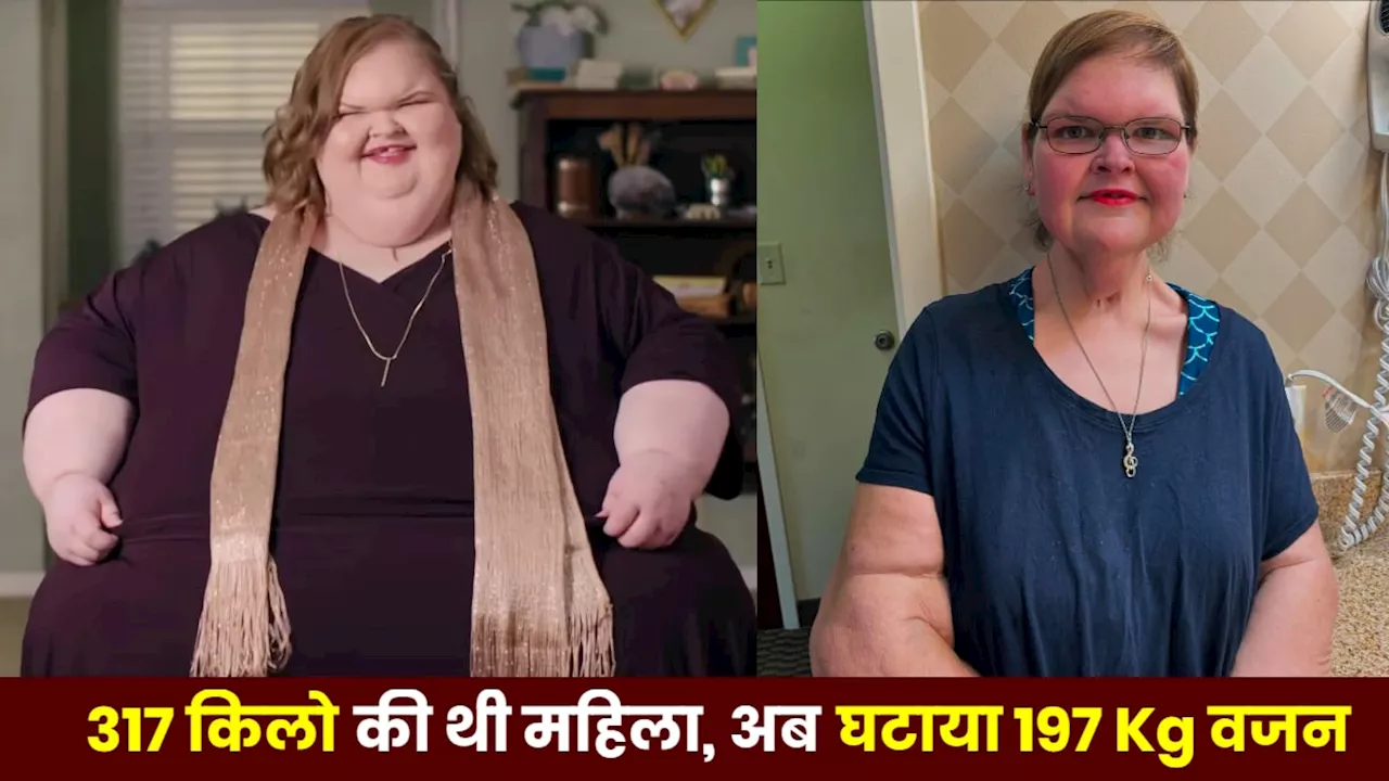 317 किलो की महिला ने घटाया 197 Kg वजन तो हुई ऐसी हालत, जानें कैसे हुआ वेट लॉस