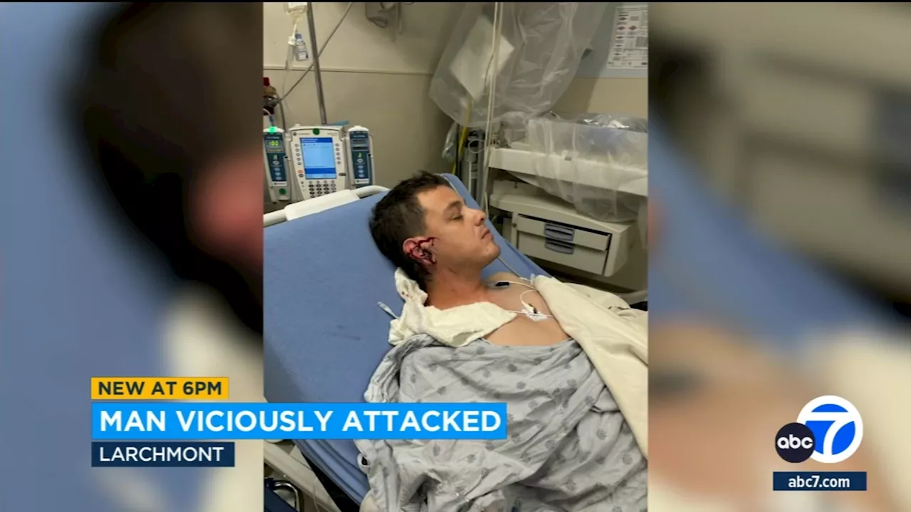 Doctors reattach half of ear that was sliced off in brutal Larchmont attack