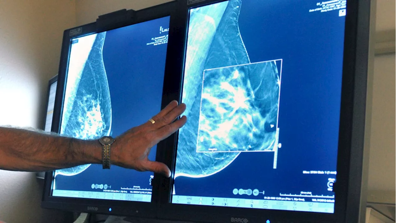 Mobile mammography unit coming to Gatineau Hospital to reduce waiting lists