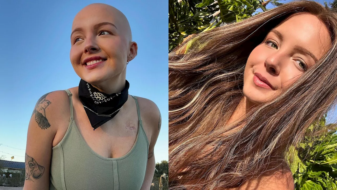 Fallece Maddy Baloy, famosa ‘tiktoker’ que relató su lucha contra el cáncer