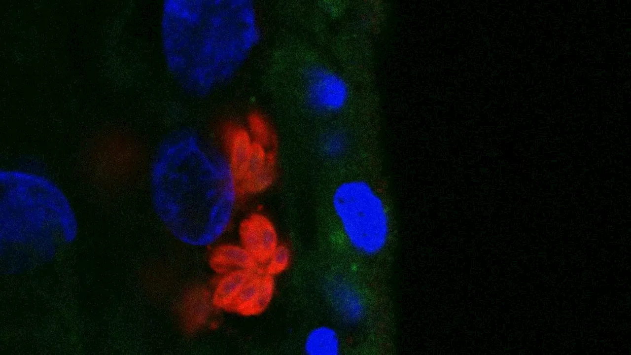 Lab-grown mini-placentas reveal clue to why pregnancy complications happen