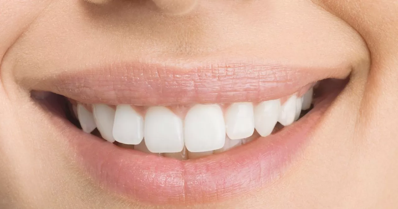 Shoppers love £20 teeth whitening product that's perfect for holidays