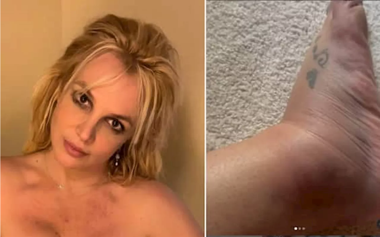 Britney Spears con la caviglia gonfia: 'Sono caduta in soggiorno'