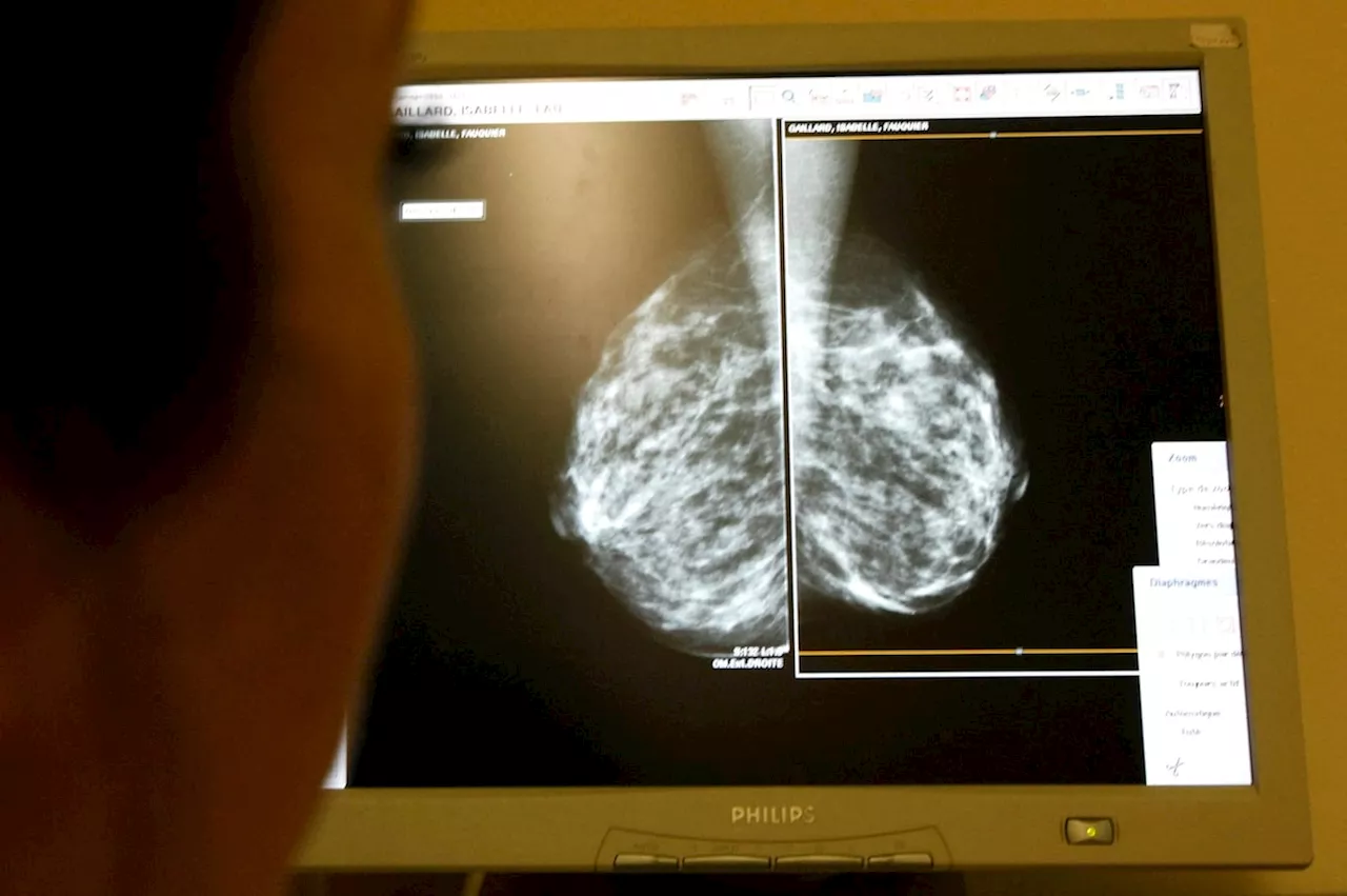 National task force opts to not advise routine breast screenings beginning at age 40