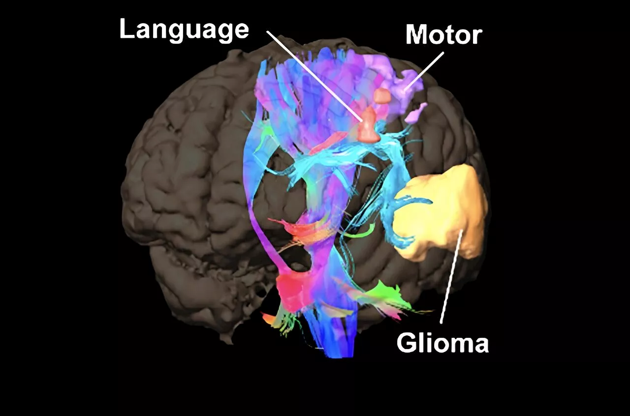 New research platform assesses brain cancer mutations during surgery