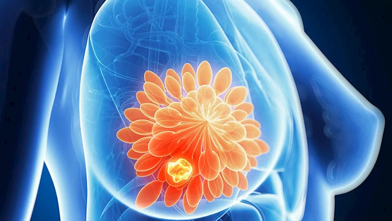 ASCO Advises on CDK4/6 Inhibitors for Breast Cancer