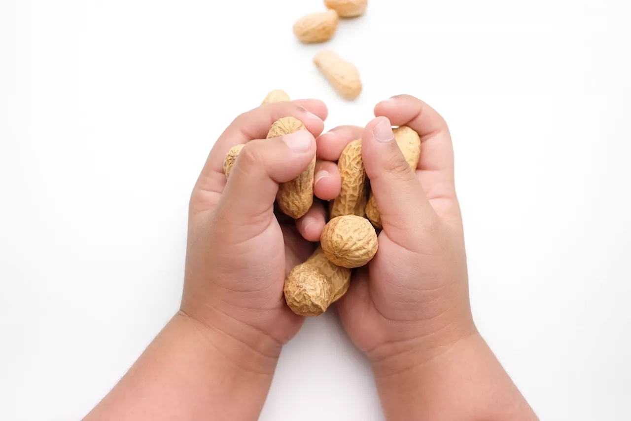 Early peanut consumption slashes allergy risk by 71%, landmark study finds