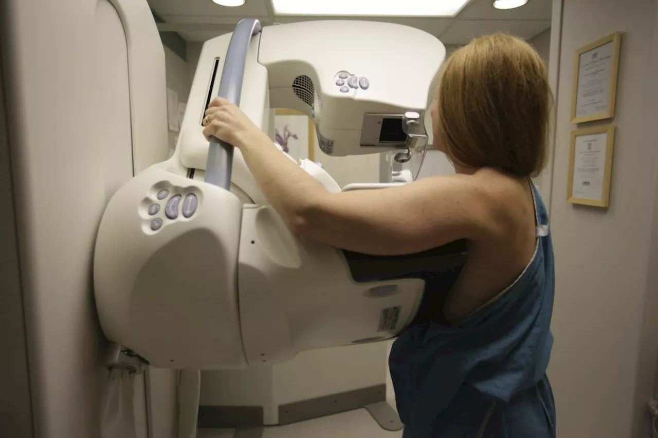 National task force not lowering age for routine breast cancer screening to 40