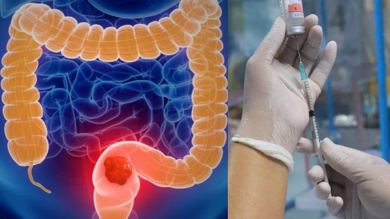 Aplican la primera vacuna personalizada contra el cáncer de colon en Reino Unido: así funciona