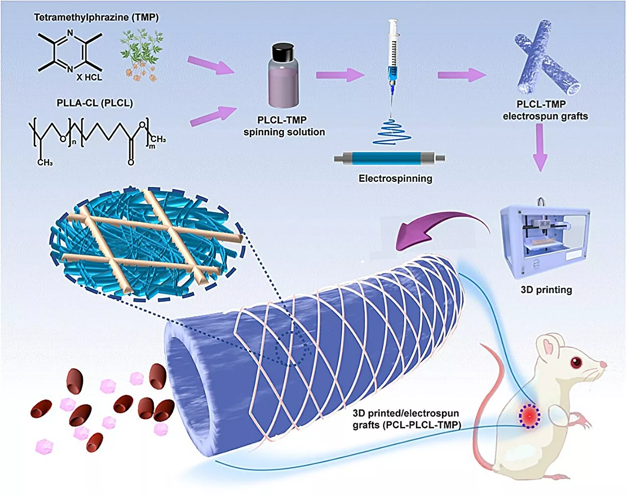 3D-printed grafts: A potential breakthrough in combating post-surgical thrombosis and aneurysm