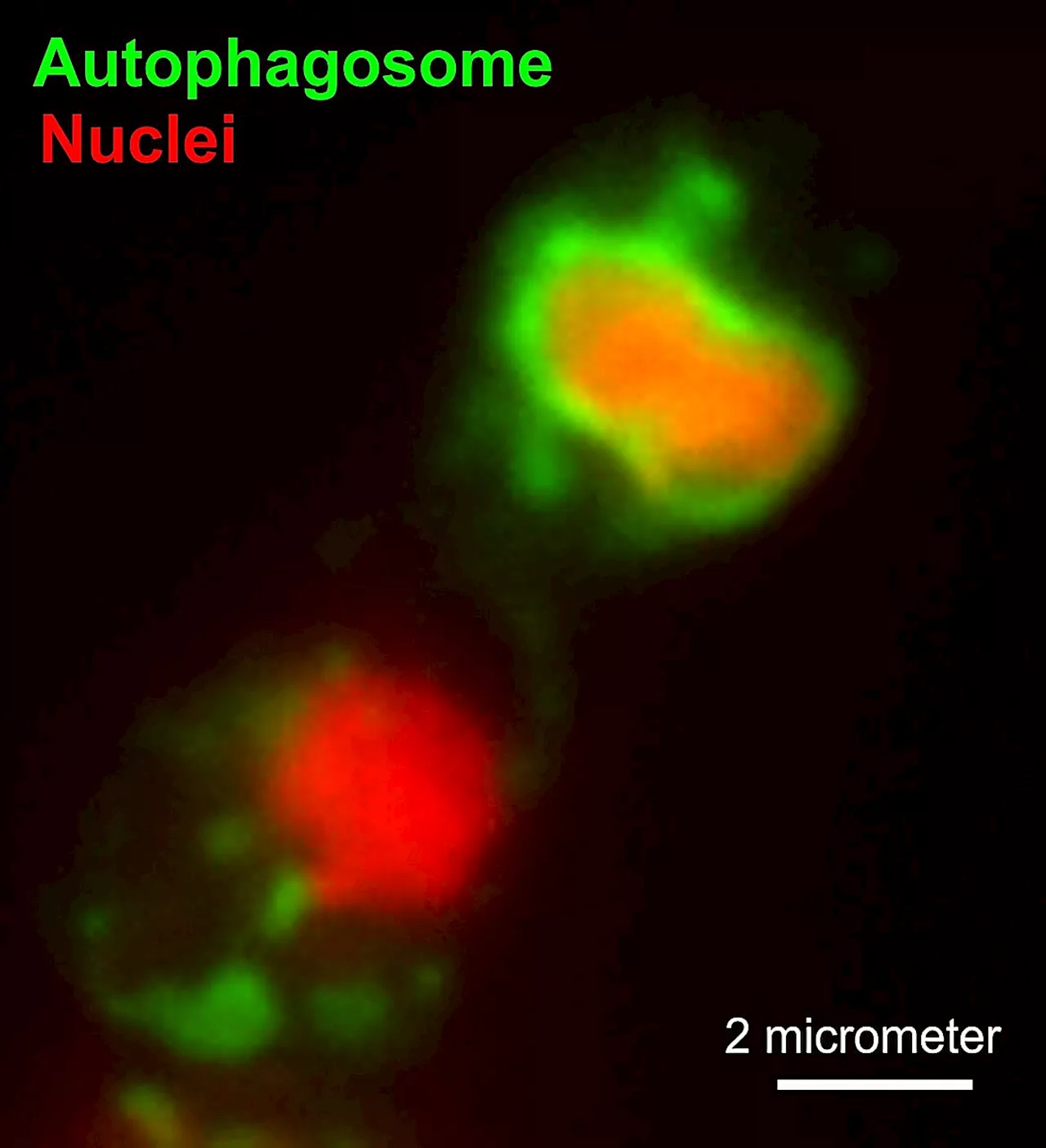 The world's most powerful anti-fungal chemistries cause fungal pathogens to self-destruct