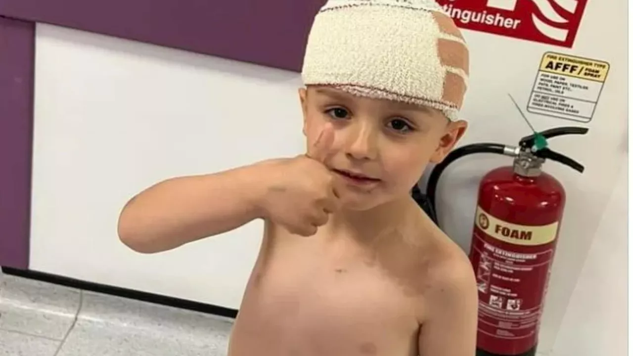 Boy, 5, has SCALP ripped off by neighbour’s XL Bully that ‘leapt on him without warning’ in horror attac...