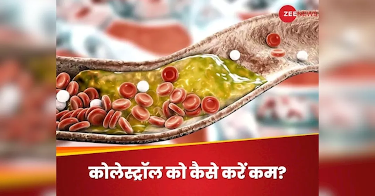 High Cholesterol: आपकी जान का दुश्मन है नसों में जमा बैड कोलेस्ट्रॉल, रोजाना 2 चीजें खाएंगे तो दूर होगा खतरा