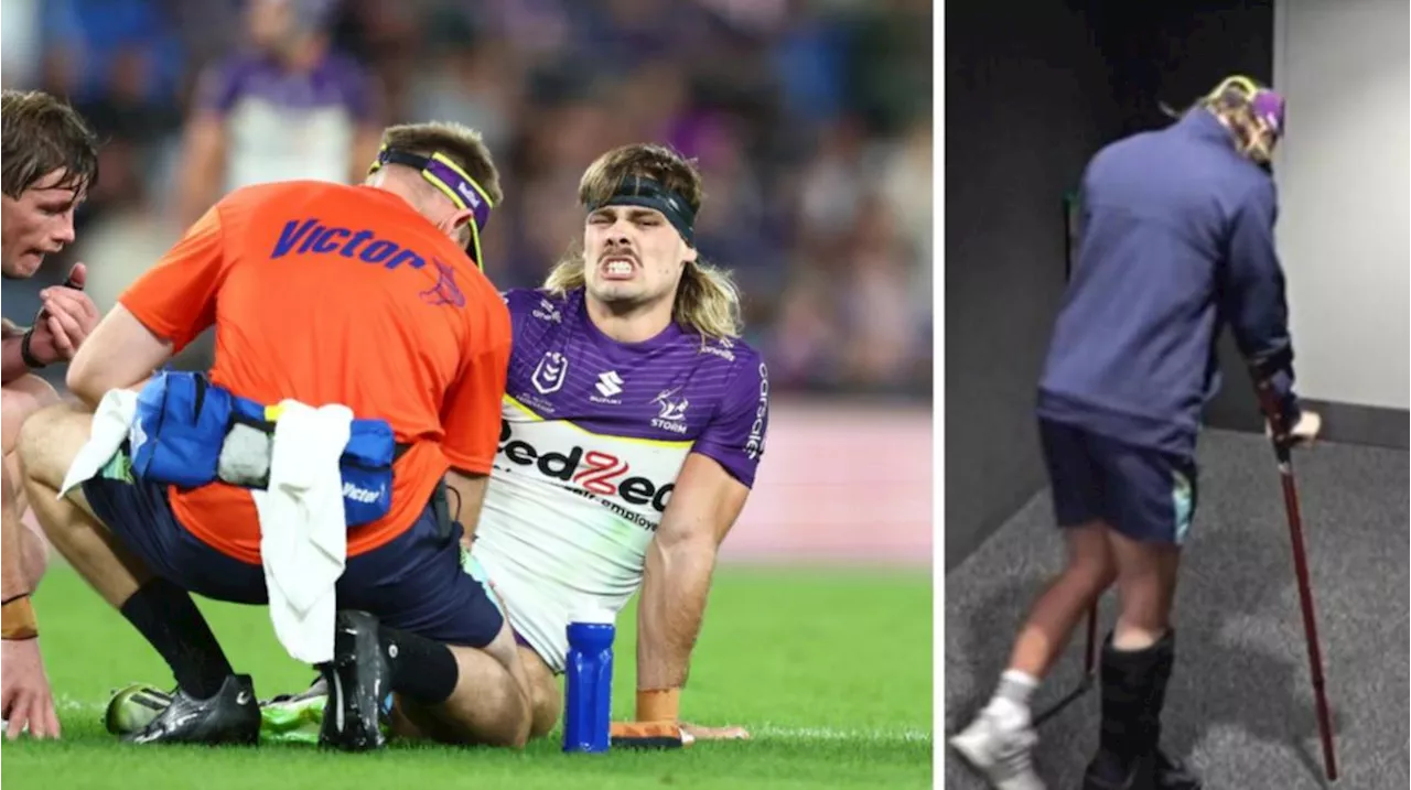 Heartbreaking scenes as Melbourne Storm star Ryan Papenhuyzen injured in win over Gold Coast Titans