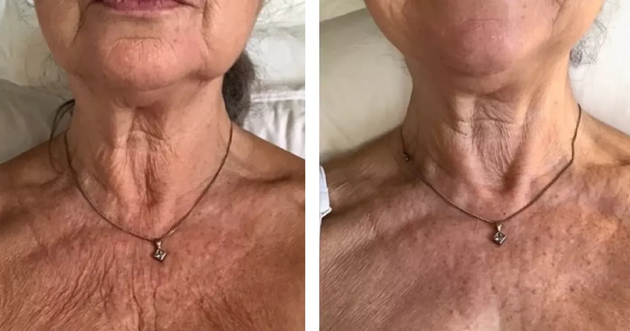 M&S shoppers hail anti-wrinkle cream for sagging necks perfect for summer