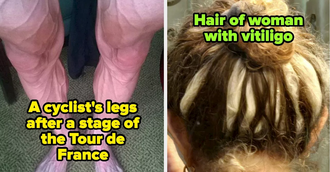 37 Truly Gnarly Photos Of The Human Body