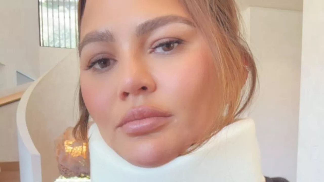 Chrissy Teigen reveals NECK BRACE after injuring herself during headstand