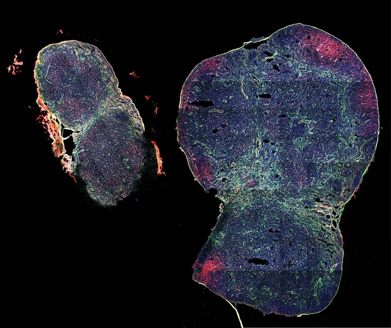 Biomaterial vaccine enhances lymph node expansion following vaccination, boosting anti-tumor immunity