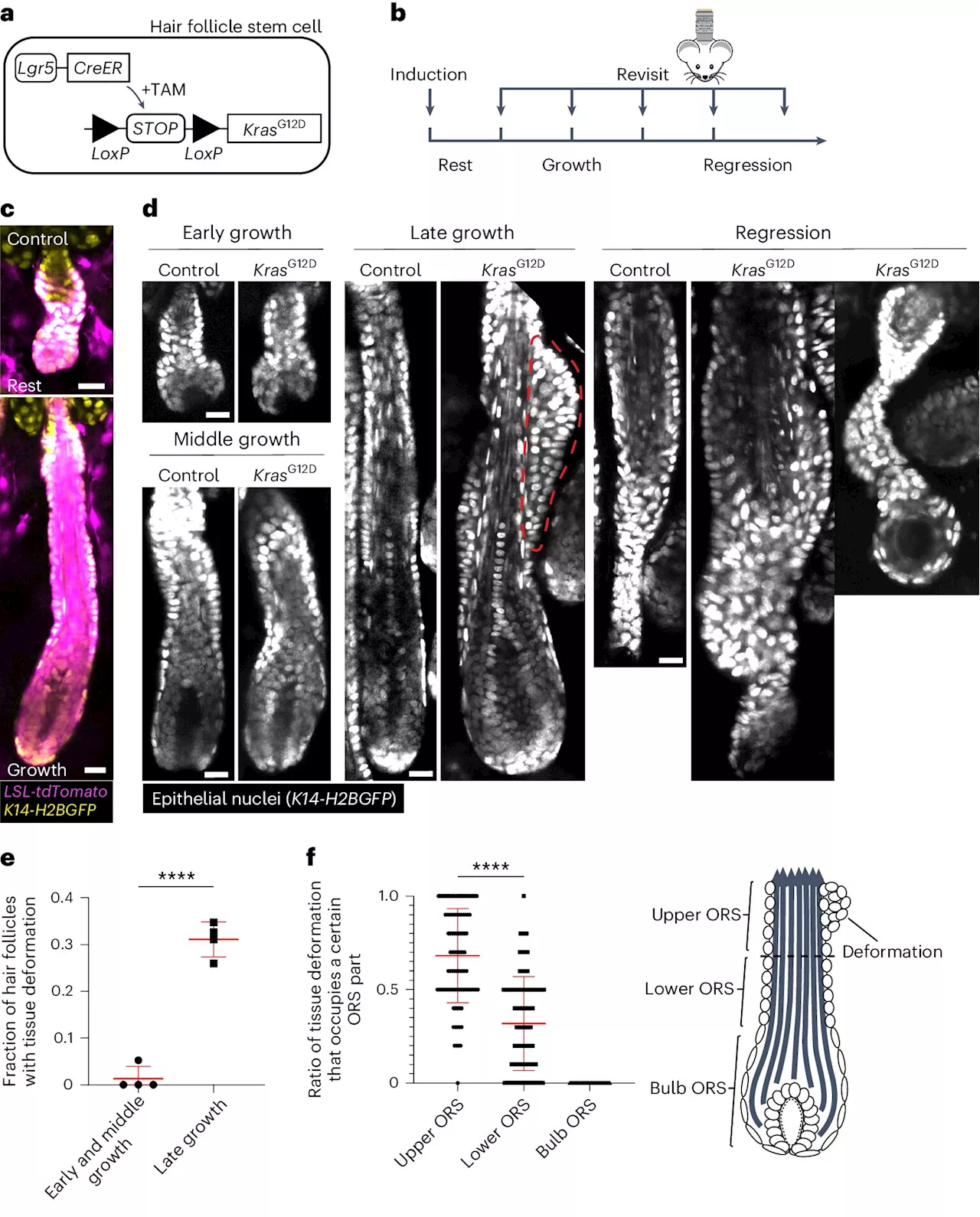 Scientists track earliest cancer-triggering physical changes in cells
