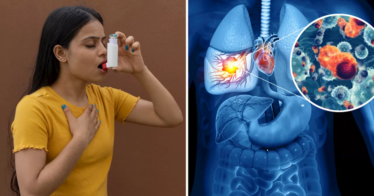 World Asthma Day: दम निकालने में देर नहीं लगाता दमा, फेफड़ों का जीवन बढ़ाना है 10 चीजों से तौबा कर लें