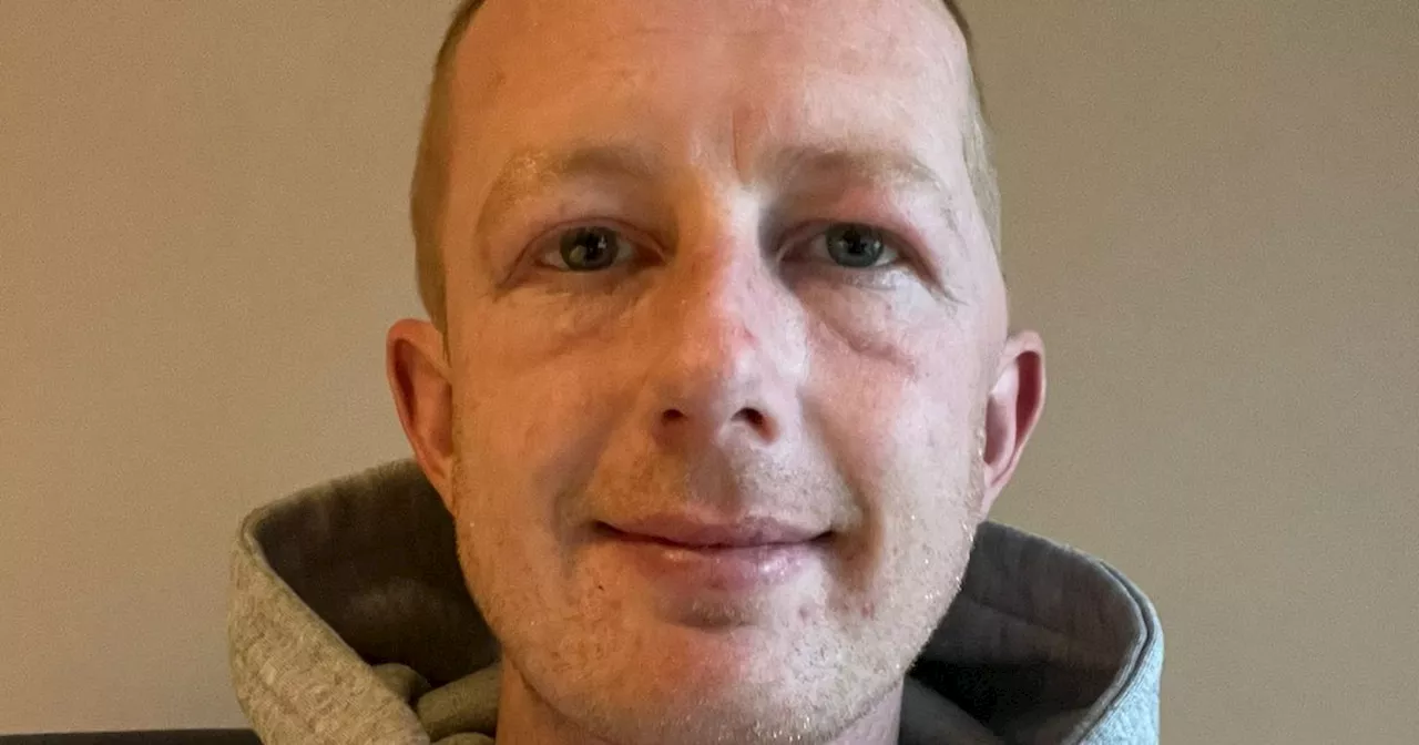 Wexford man says epilepsy cost him friends but he's not letting it hold him back