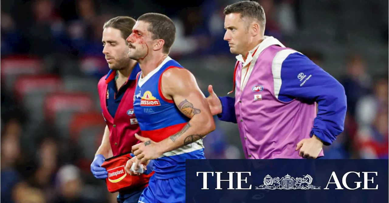 Bulldogs rule Tom Liberatore out indefinitely after fourth concussion in 12 months