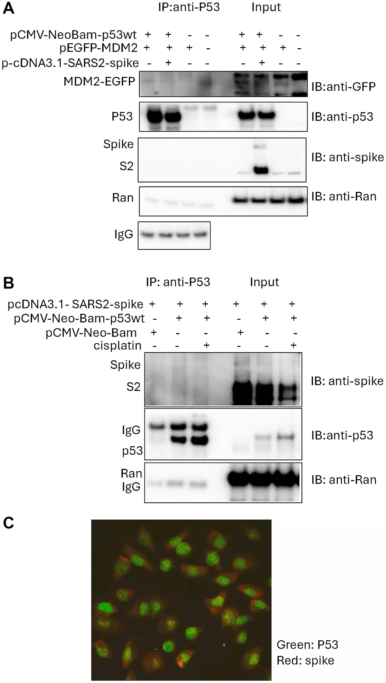 Transfected SARS-CoV-2 spike DNA suppresses cancer cell response to chemotherapy