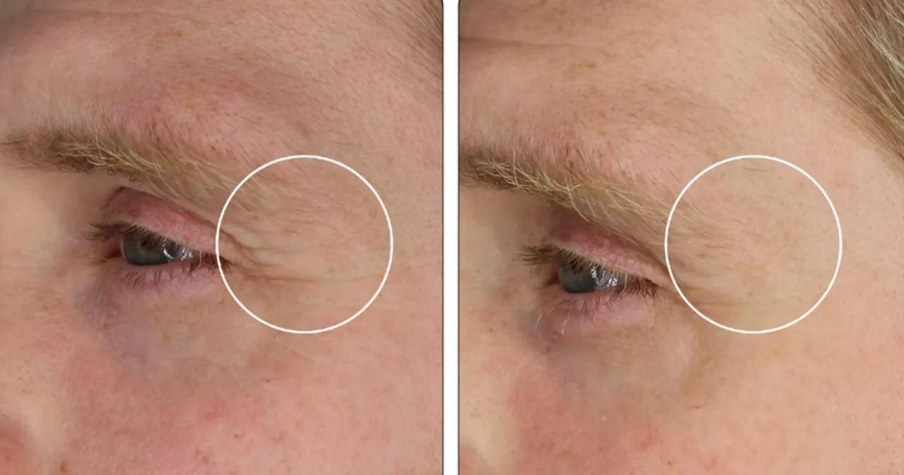 Beauty buffs say 'powerful' £10 anti-aging solution works on deepest of wrinkles