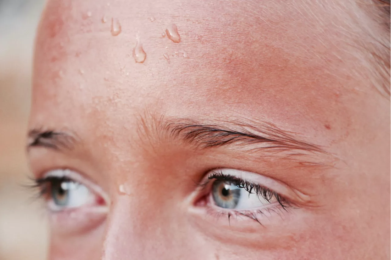 Iloilo response teams record spike in cases of heat illnesses