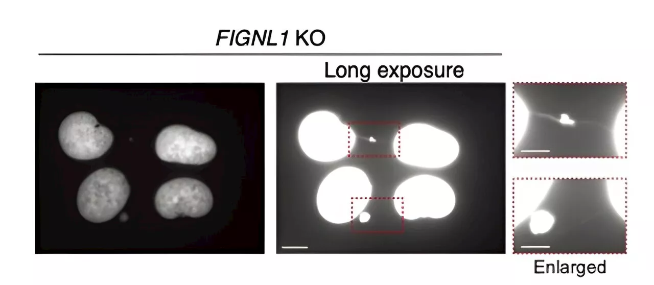 Researchers study the intricacies of homologous recombination and abnormal chromosome bridges