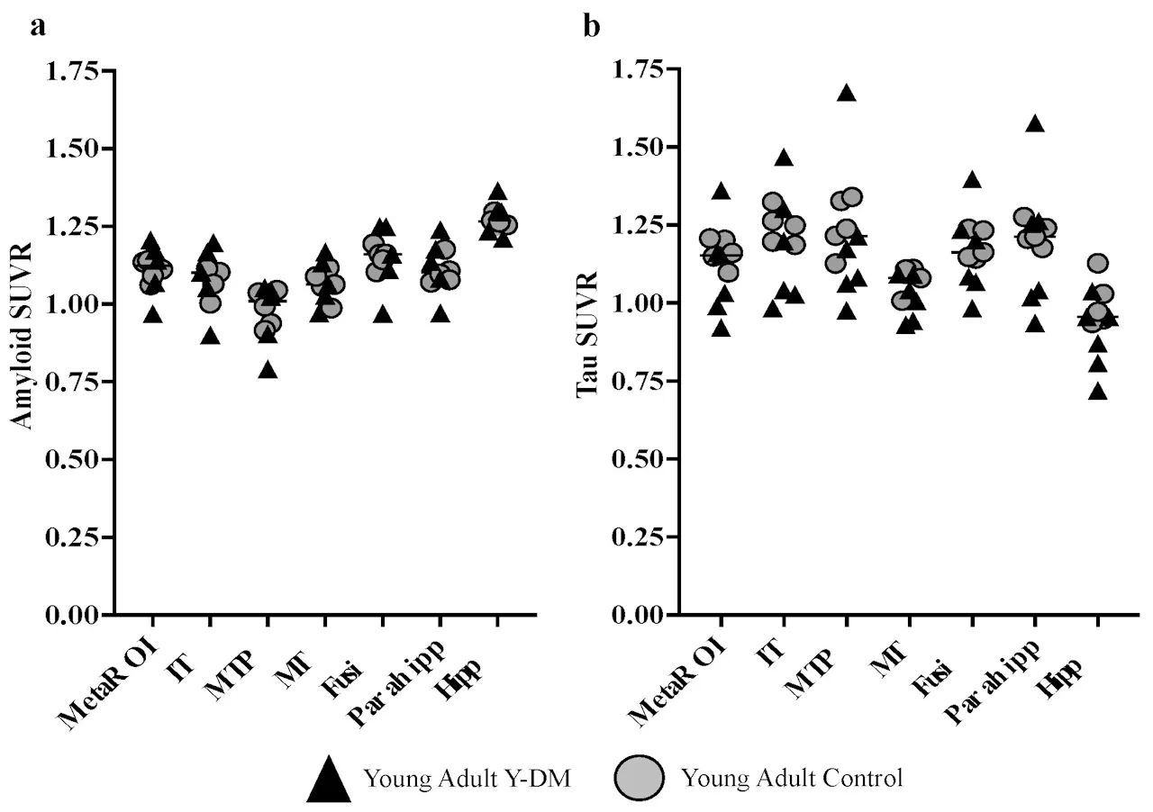 Diabetes in youth may increase risk for neurodegenerative disease, like Alzheimer's disease, later in life