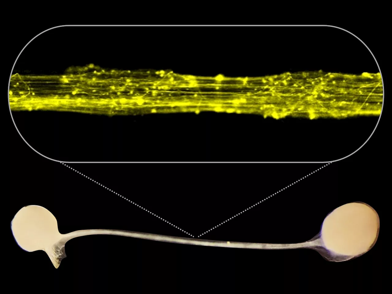 Researchers develop first model of the brain's information highways