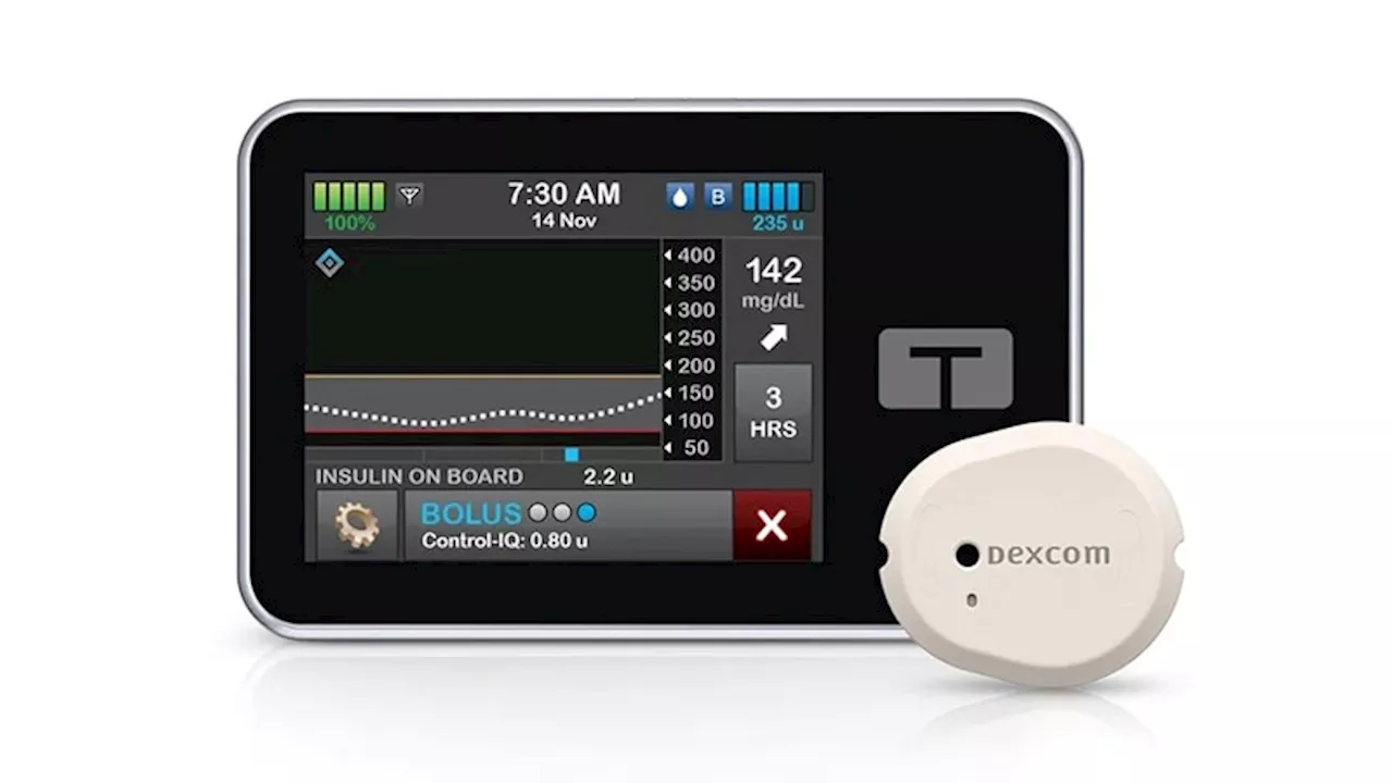 Tandem Recall Urges Updating App Used With Insulin Pump