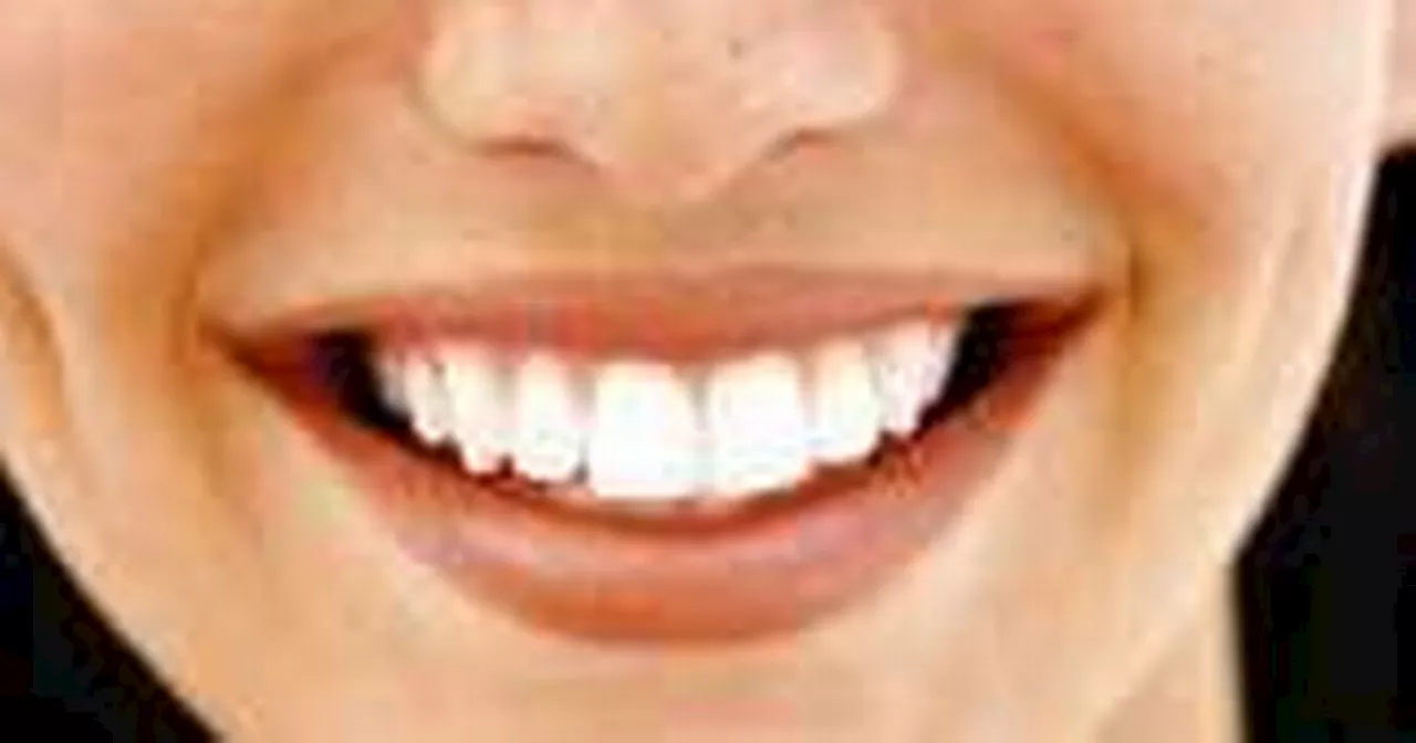 Shoppers insist Boots £10 teeth whitening kit gives better results than dentist