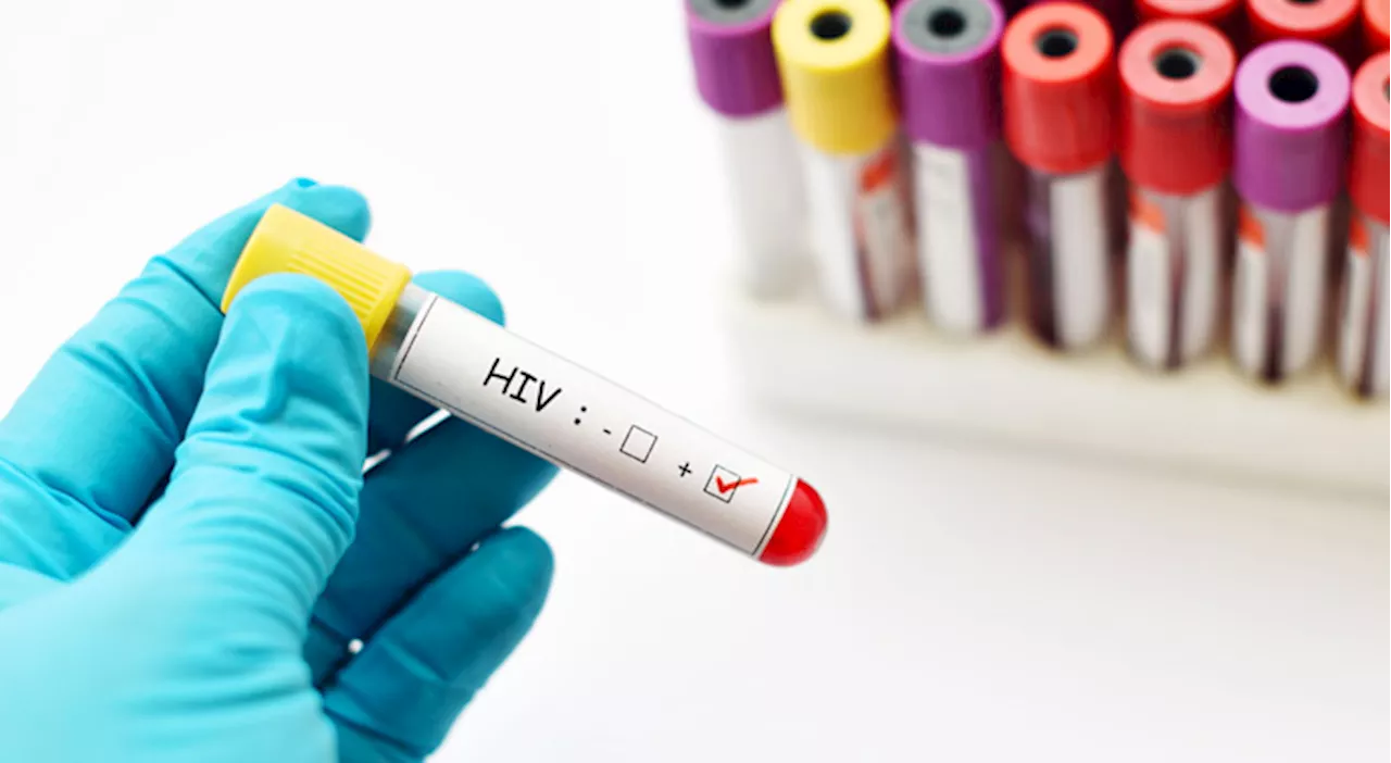 HIV: record di nuovi casi in Europa, l’allarme dell’OMS