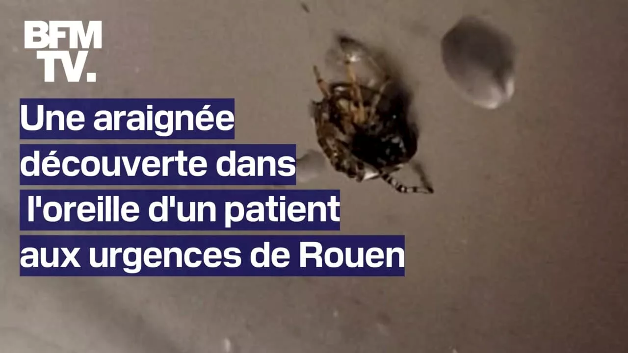 Une araignée retrouvée dans l'oreille d'un patient aux urgences de Rouen