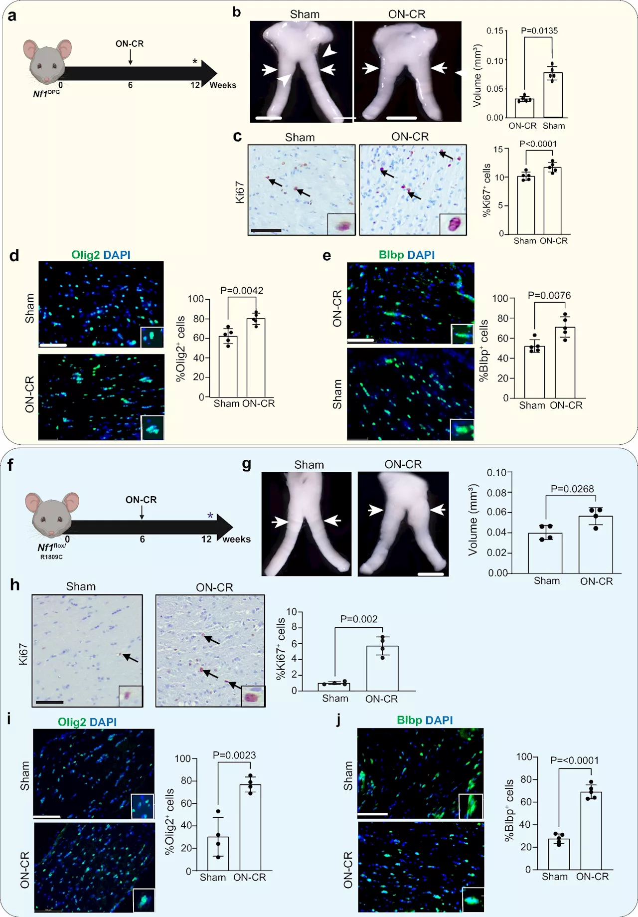 Some brain tumors may be linked to head injury, mouse study suggests