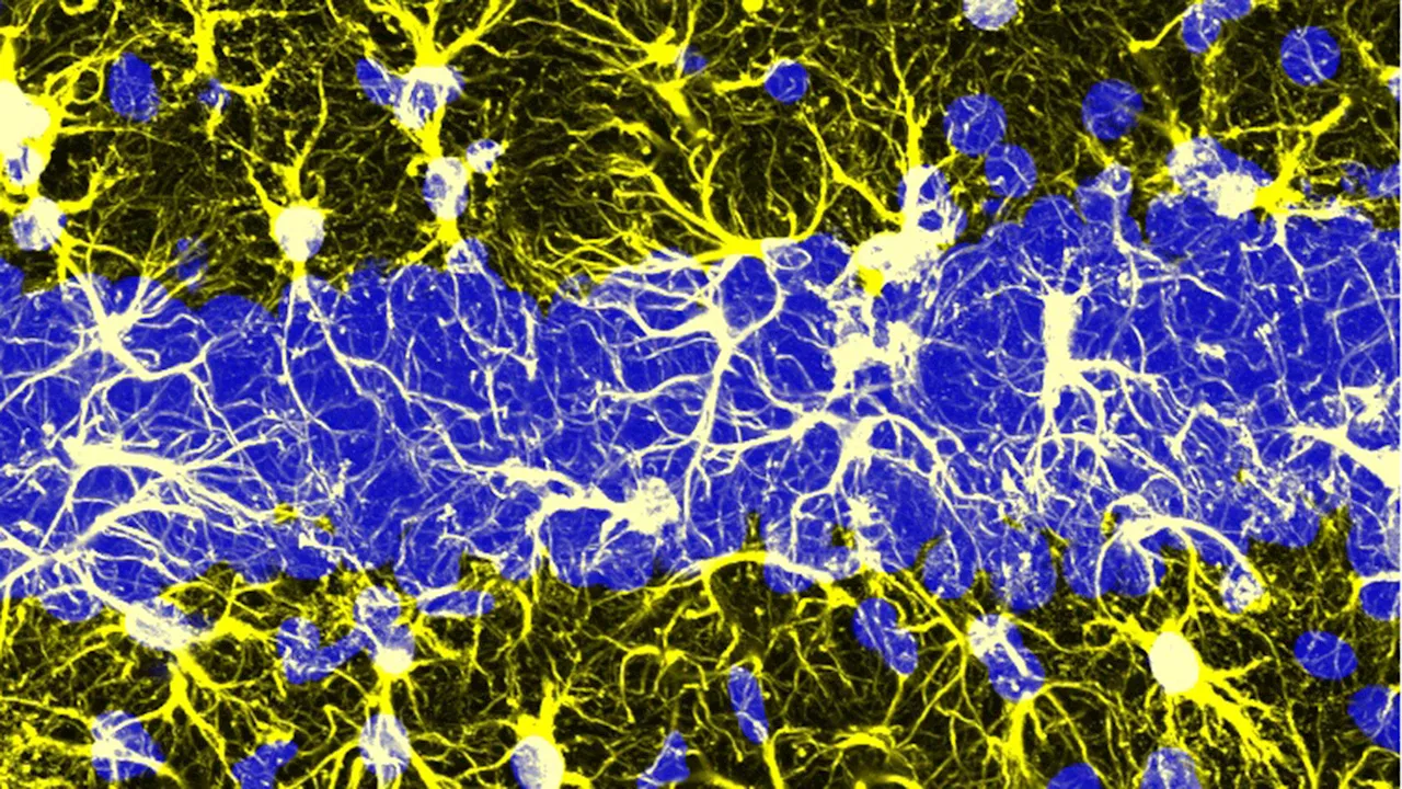 Study shows that astrocytes integrate information about past events in their soma