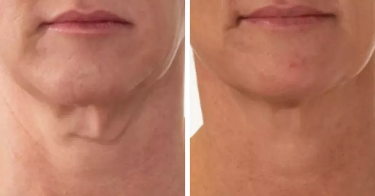 Marks and Spencer shoppers snap up 'award-winning' £29 sagging neck cream for £2