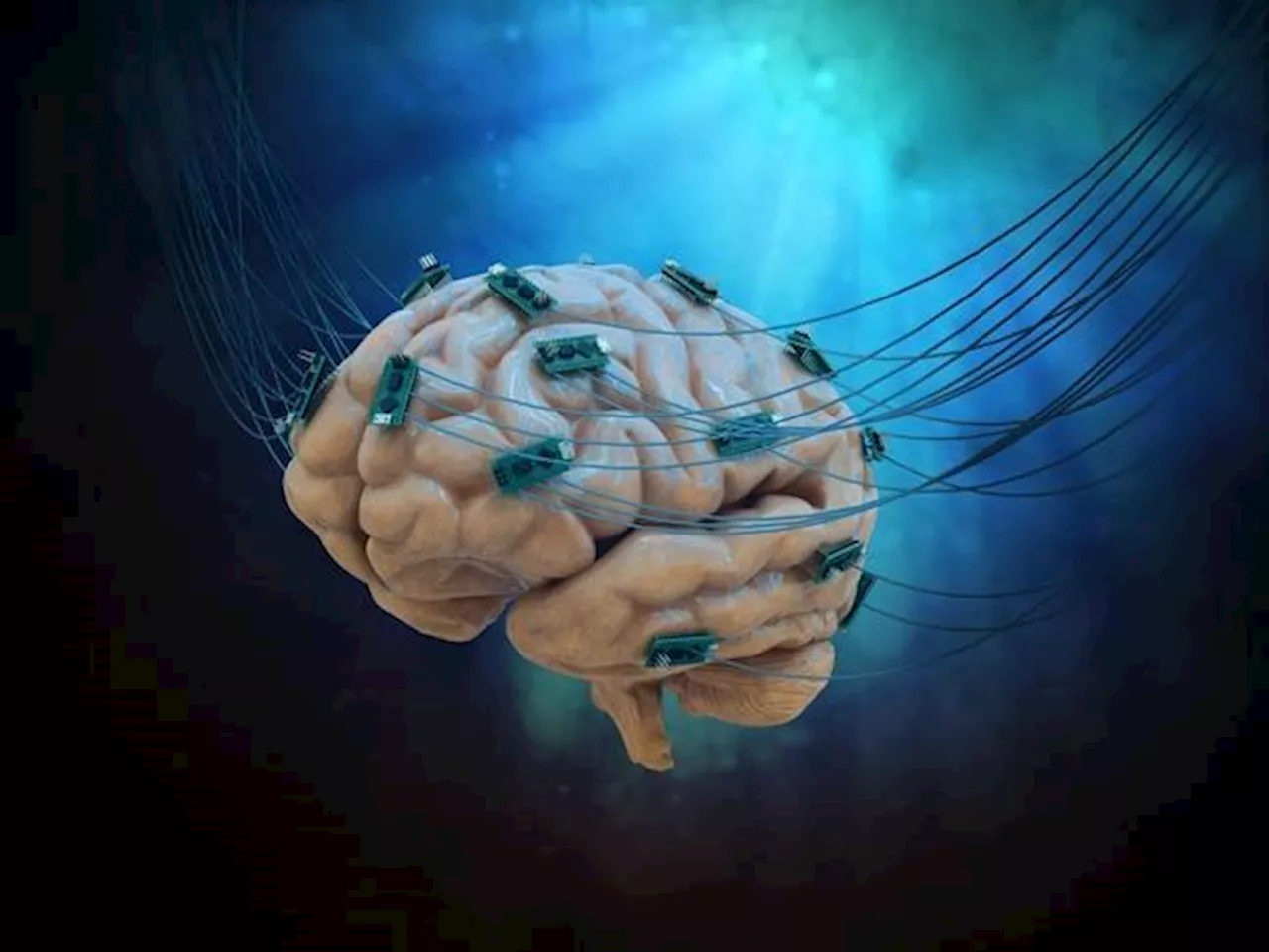 Brain-sensing threads slip from gray matter in first human Neuralink trial