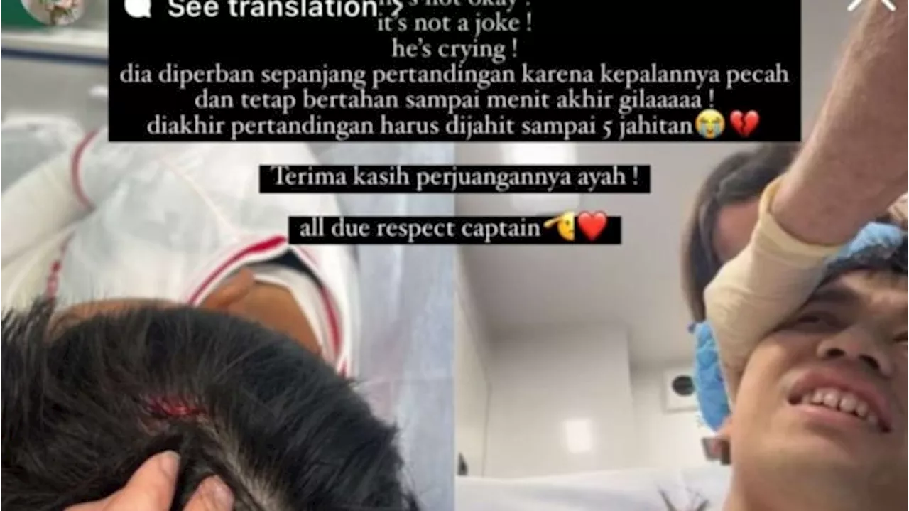 Witan Sulaeman Pecah Kepala Saat Timnas Indonesia Vs Guinea, Sang Istri Langsung Ungkap Kondisinya