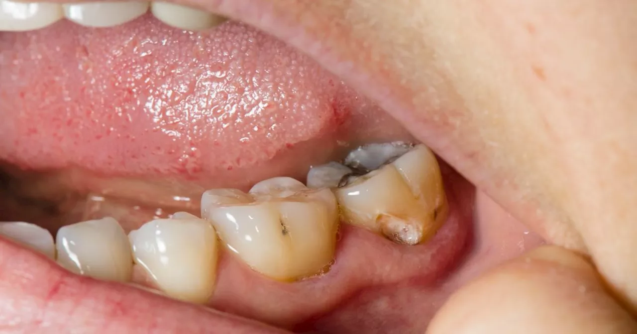 Dentist reveals five serious health problems that come from poor oral hygiene