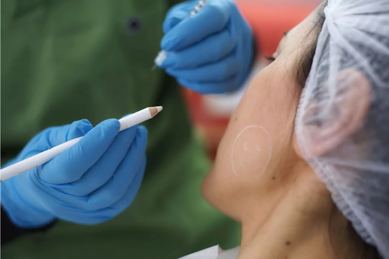 Medici contro i botox bar, 'rivolgersi agli specialisti esperti'