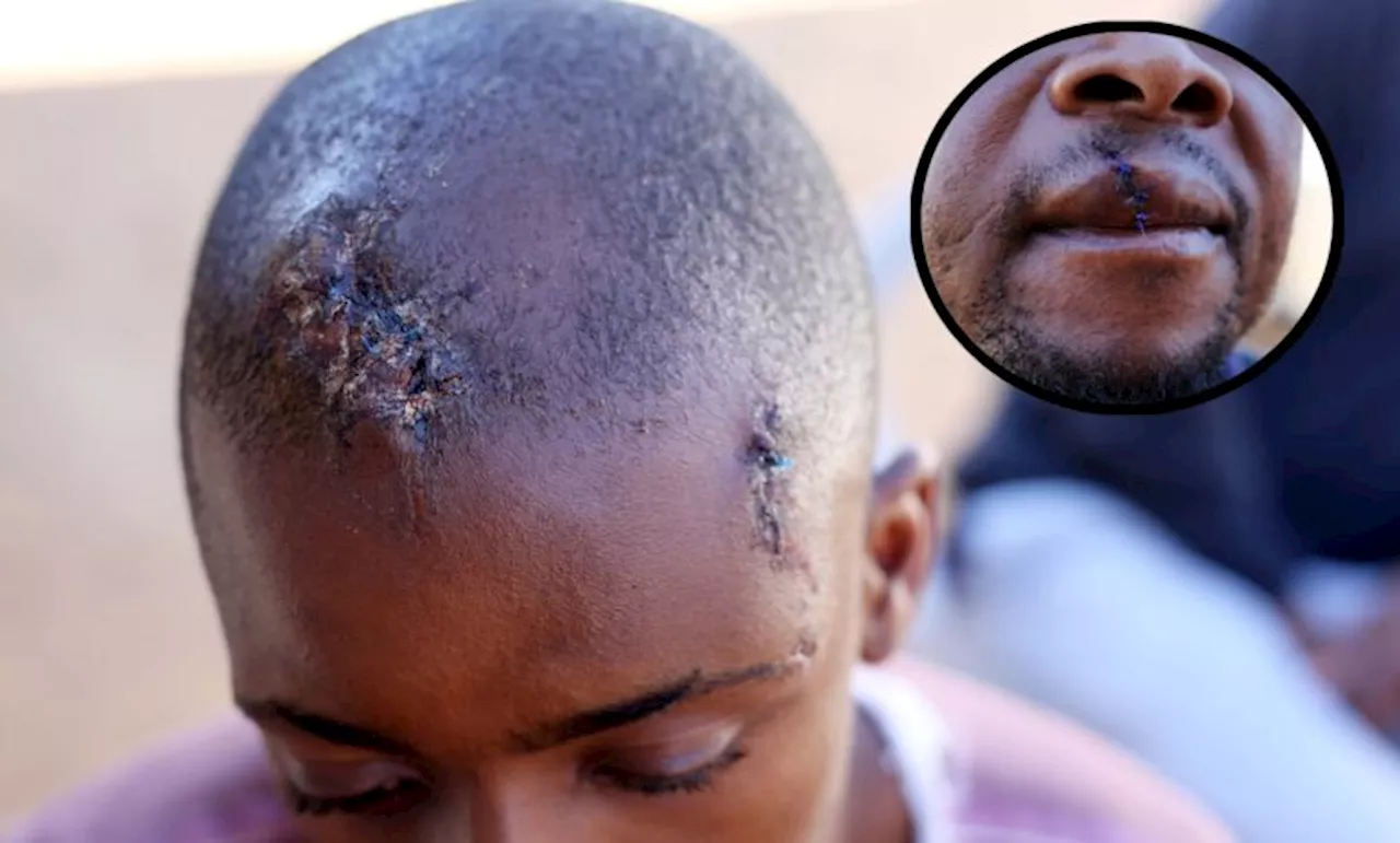 Robbers brutally assault Gauteng father and son