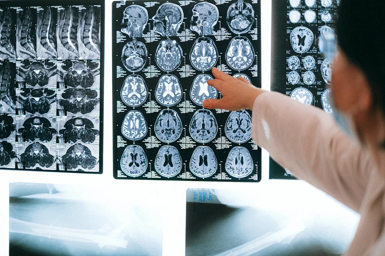 National working group releases ethical guidance for new portable MRI brain research