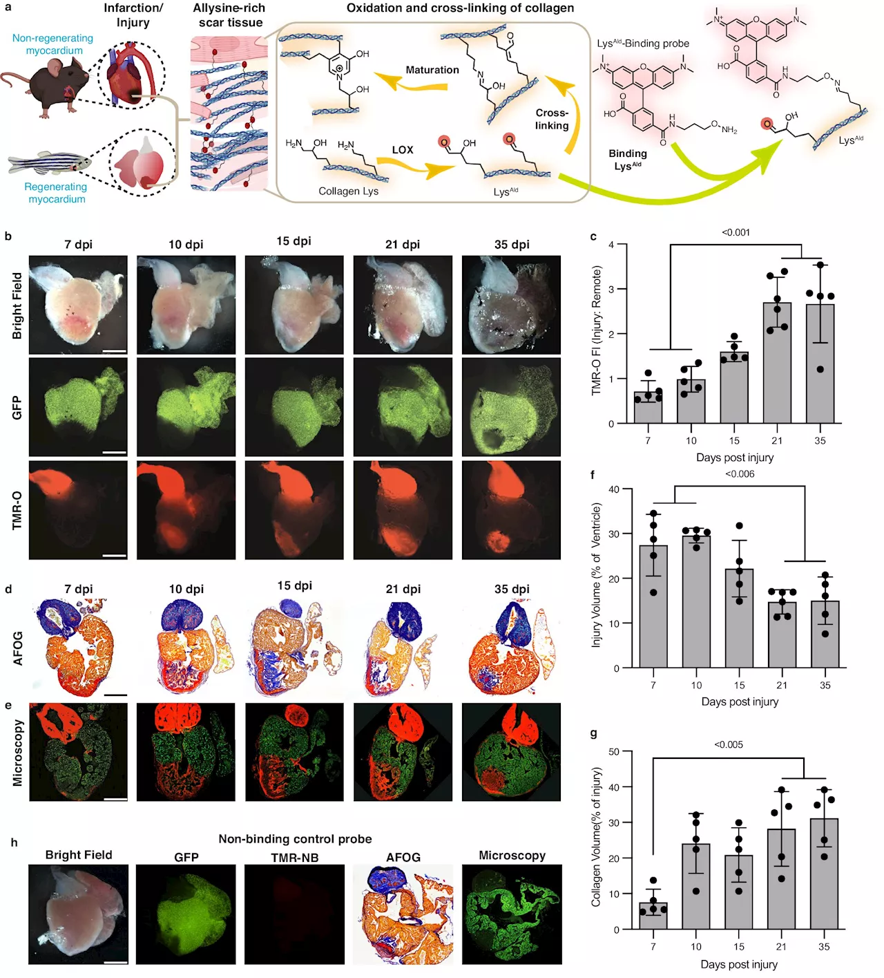 Study reveals target for reversing scar tissue after heart attack