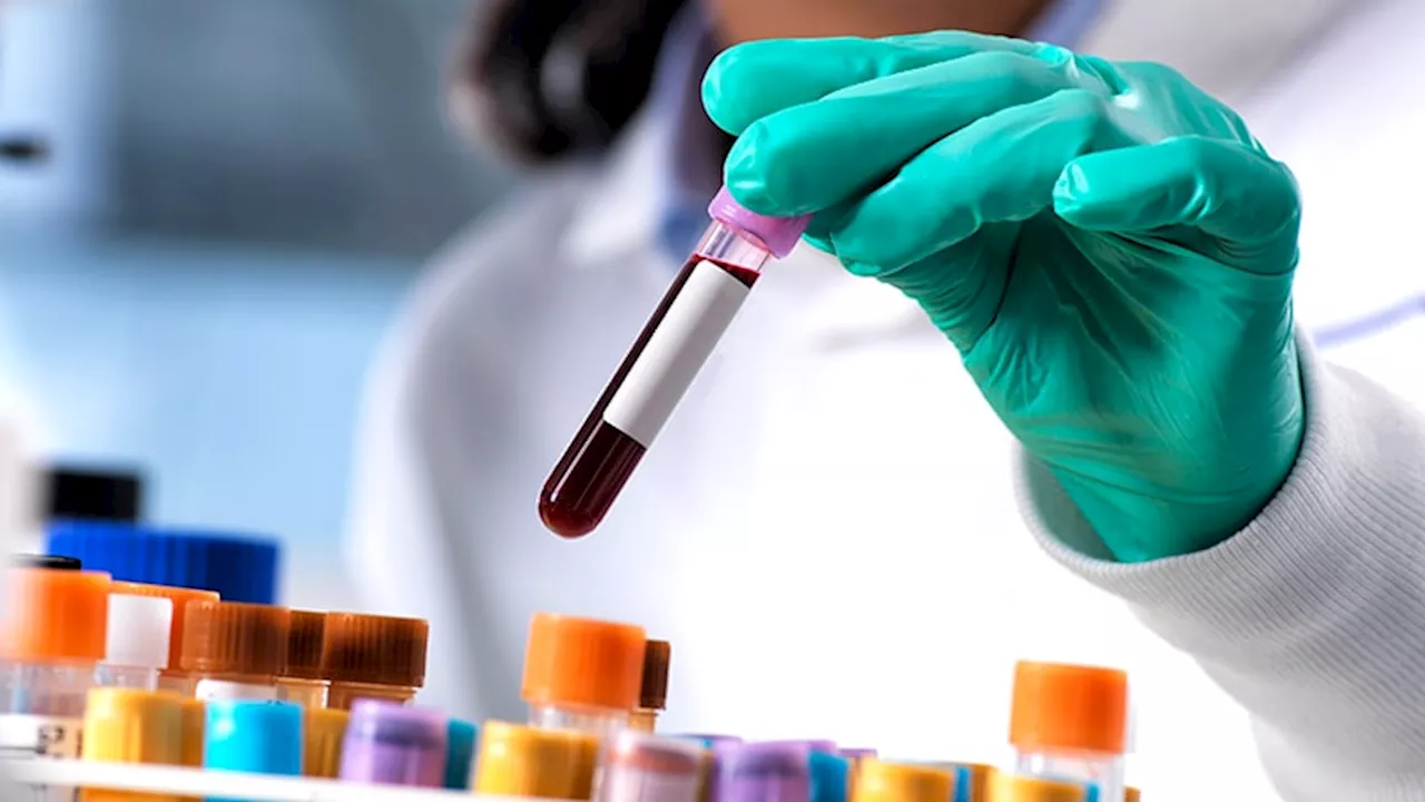 Blood Test a 'Game Changer' for Faster Diagnosis, Treatment of LVO Stroke