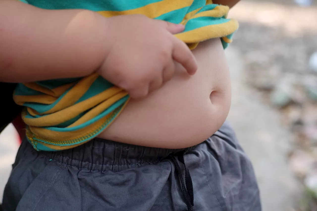 Study uncovers gut microbes' role in childhood obesity