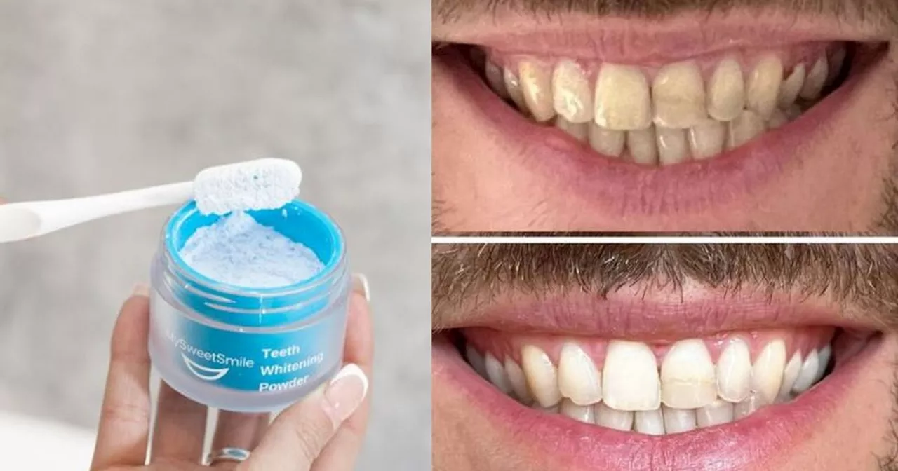 'Impressive' £25 teeth whitening powder 'removed stains thought to be permanent'